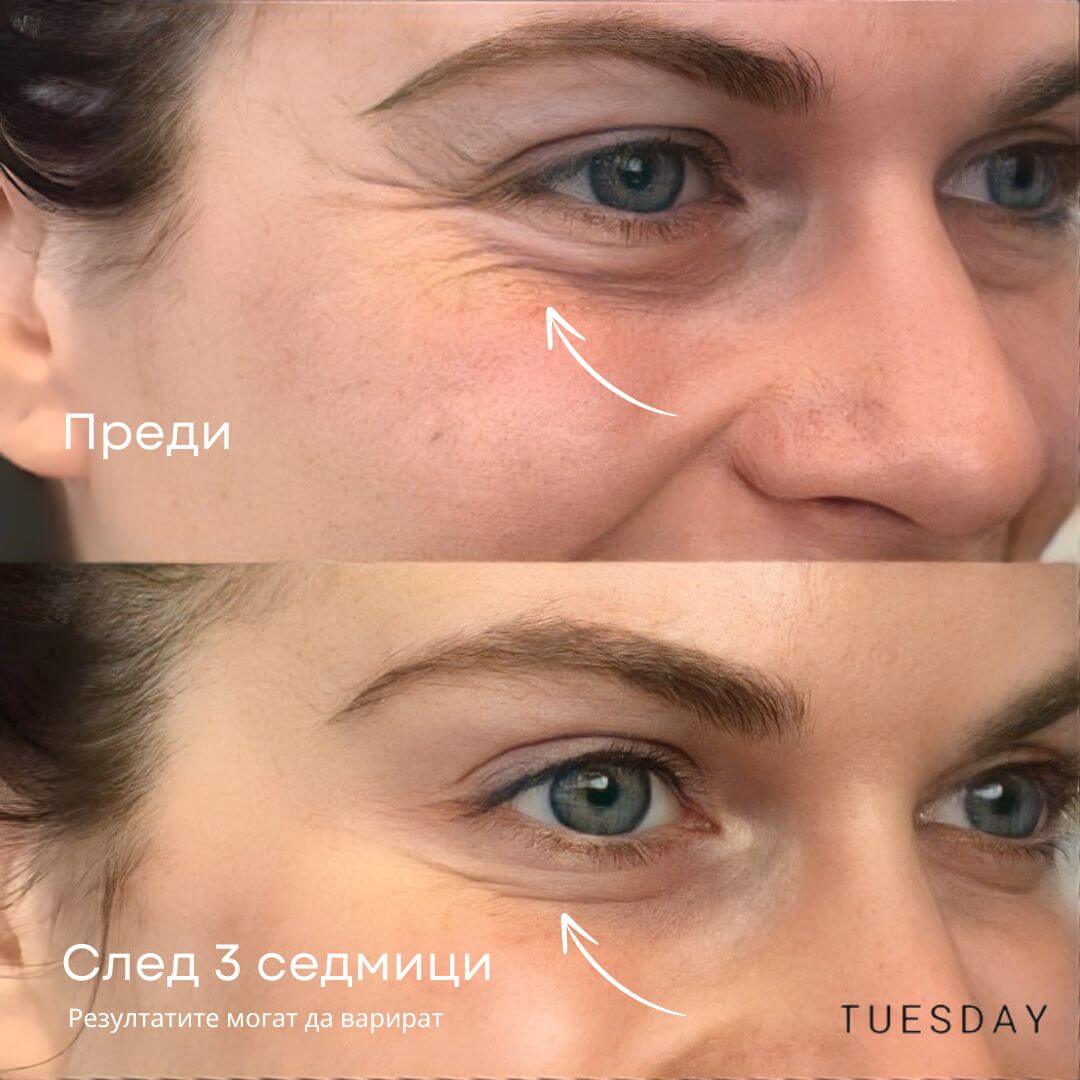 GlowLift Ретинолов стик за очи