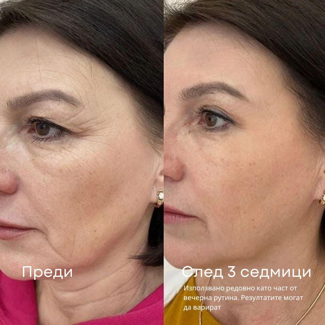 Обновяваща Стягаща Грижа с Ретинал